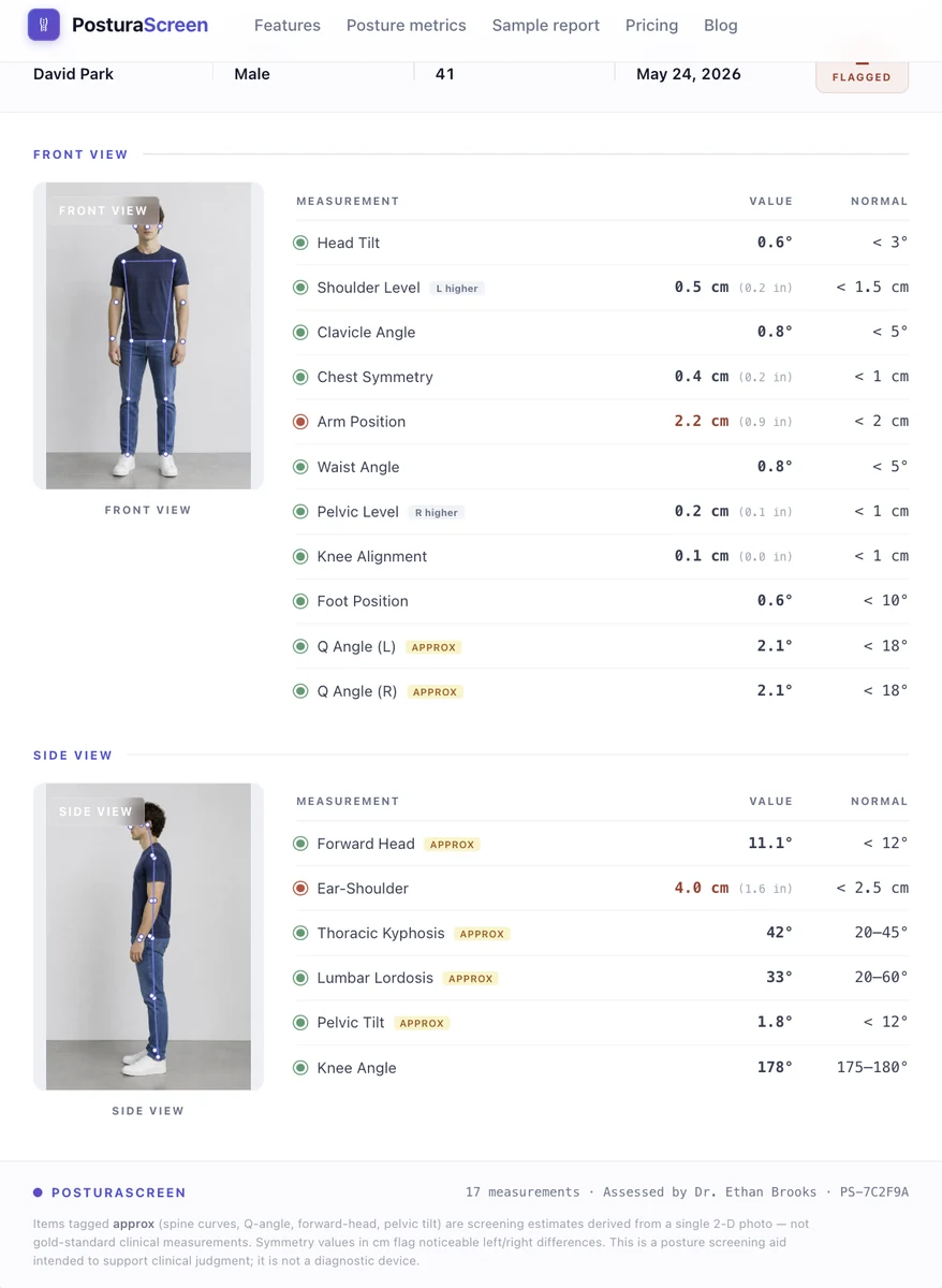 PosturaScreen sample report excerpt showing pelvic tilt measurement with the approx tag