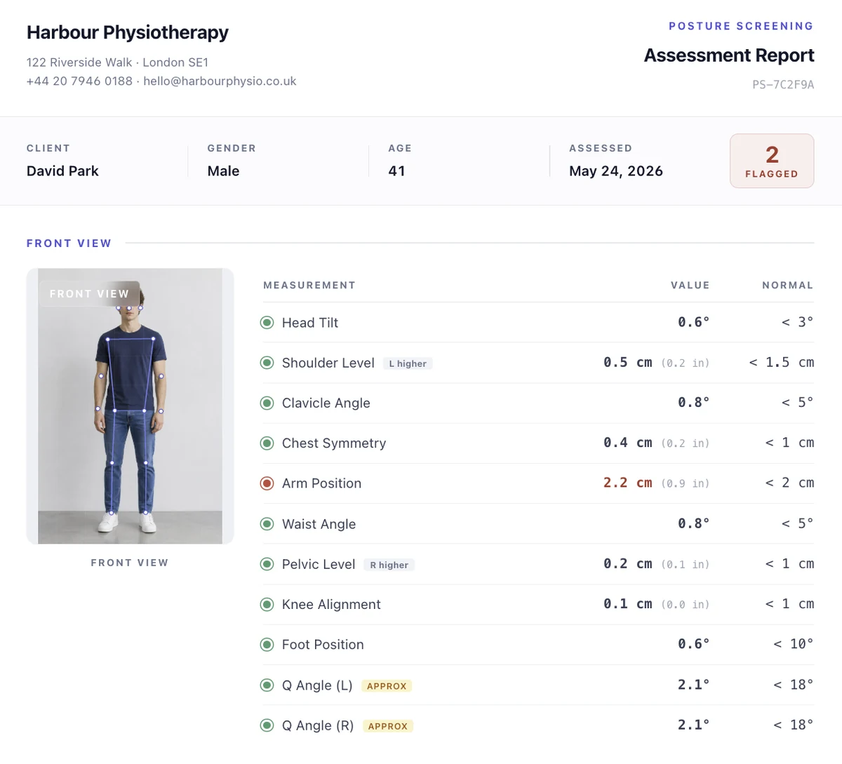 PosturaScreen sample report excerpt showing front-view symmetry metrics including Shoulder Level and Pelvic Level with left and right indicators