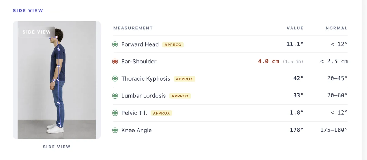 PosturaScreen sample report excerpt showing the forward head angle metric for neck posture