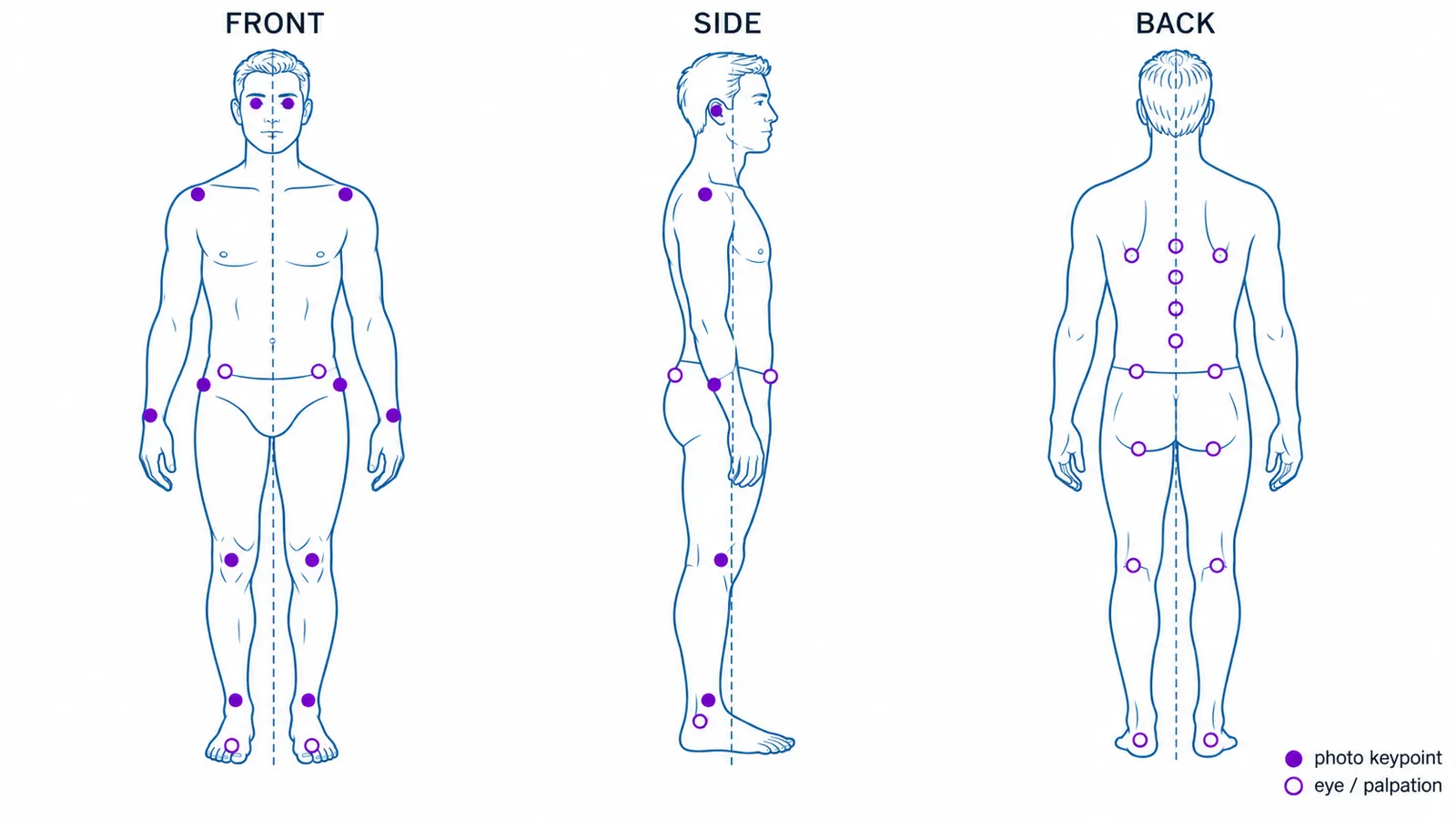 Tre disegni al tratto della stessa persona in piedi, di fronte, di lato e da dietro, ciascuno con una linea di riferimento verticale tratteggiata. I punti di repere sono indicati da pallini: linea degli occhi, spalle, polsi, anche, ginocchia e caviglie nella vista frontale; orecchio, spalla, anca, ginocchio e caviglia esterna nella vista laterale; scapole, colonna, bacino, pieghe poplitee e talloni nella vista posteriore. I pallini pieni indicano i punti che uno strumento a due foto può localizzare; quelli vuoti i punti controllati a occhio o alla palpazione