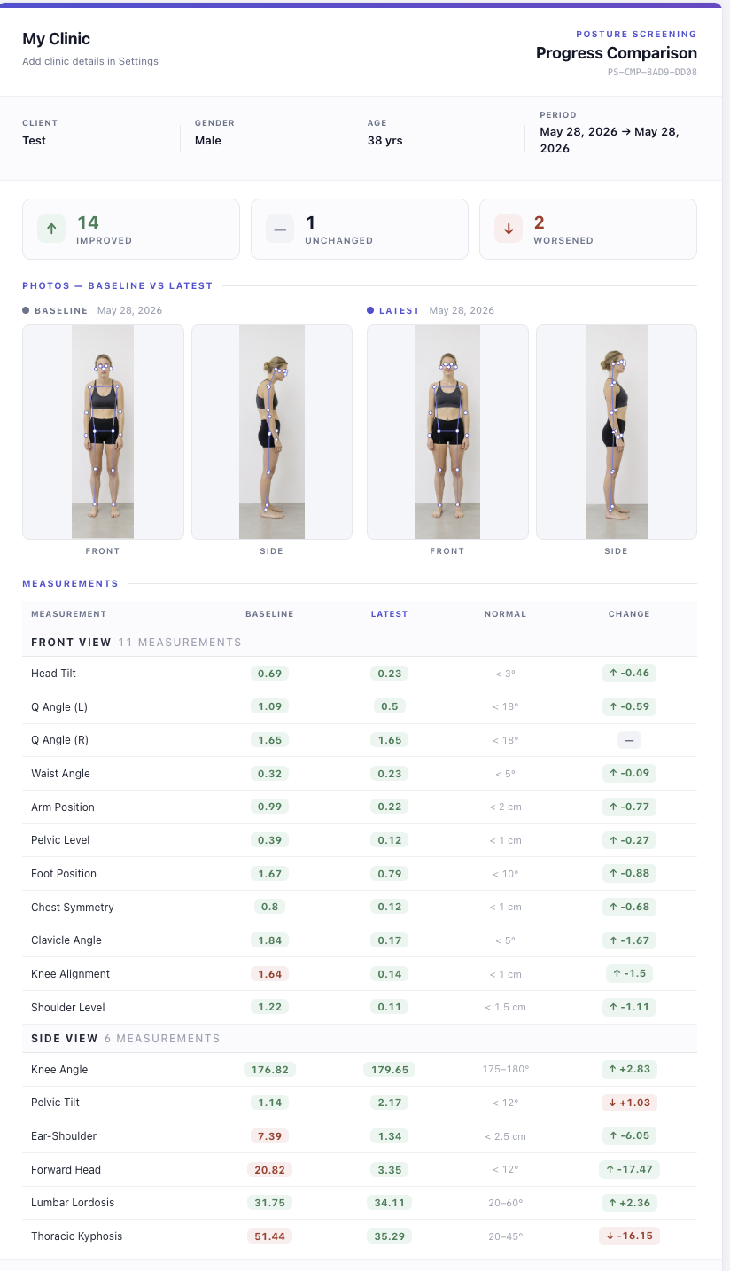 PosturaScreen Compare view — baseline vs latest assessment with deltas